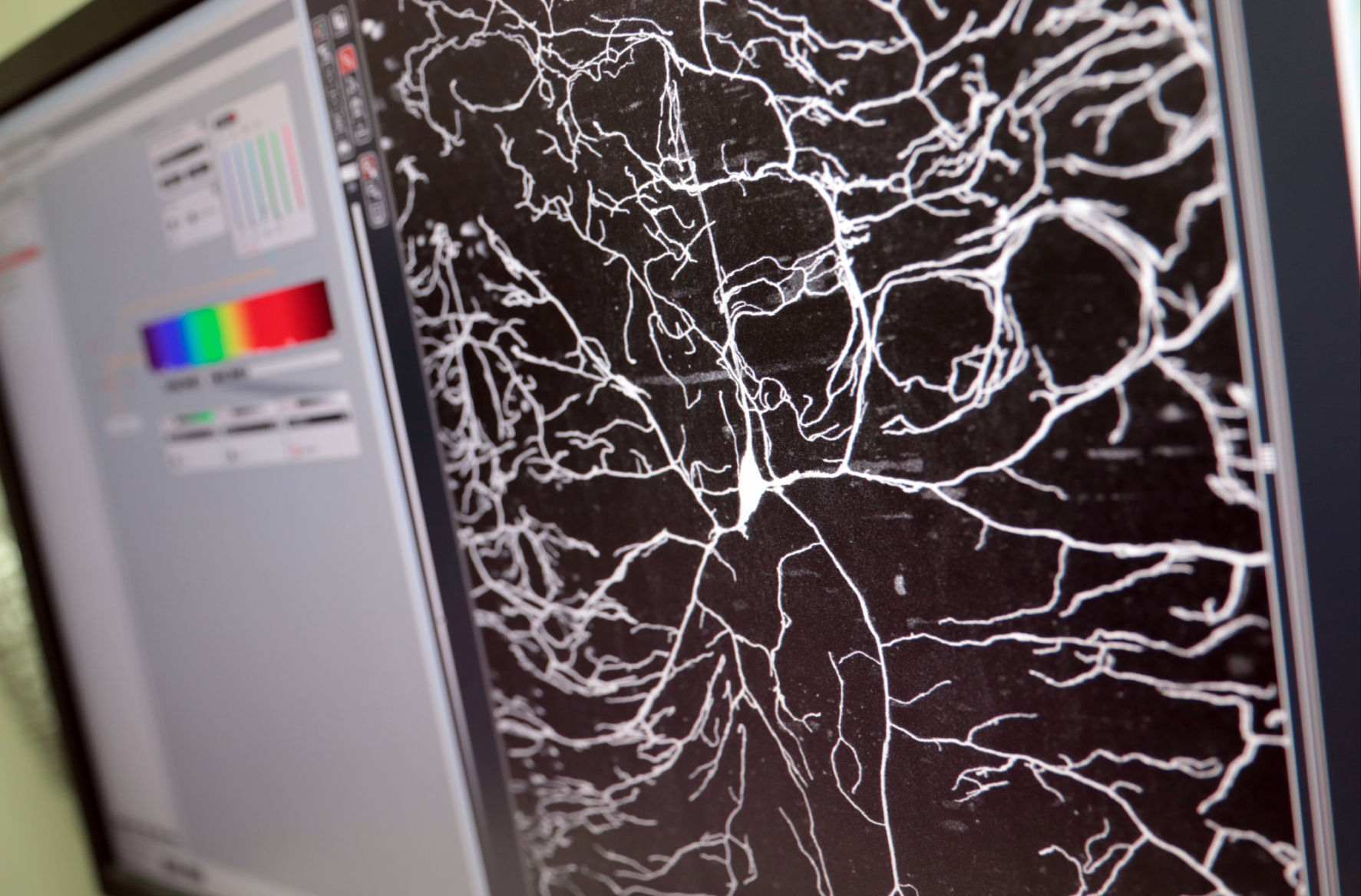 Fruit fly neuron microscope image